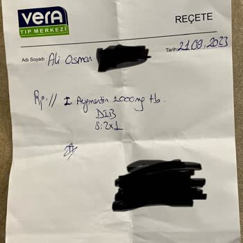Avrupa Diş Polikliniği İltihaplı Diş Tanısı Konulan Dişi Çektiler