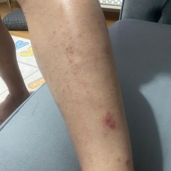 A101 Agiss Tüy Dökücü Köpük