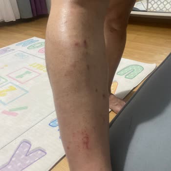 A101 Agiss Tüy Dökücü Köpük