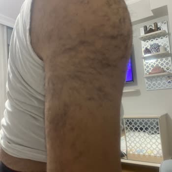 A101 Agiss Tüy Dökücü Köpük