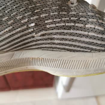 Skechers Erkek Ayakkabı Sorunu