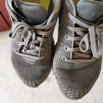 Skechers Erkek Ayakkabı Sorunu