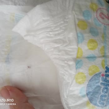 Molfix Bebek Bezindeki Siyahlık