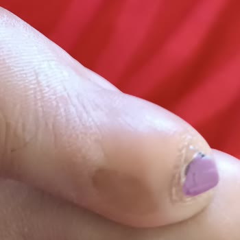 Greyder'den Aldığım Sandaletler Ayağımı Yaralıyor Ve İade Talebim Reddedildi
