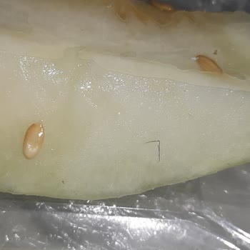 Eskişehir Osmangazi Üniversitesi Hastanesi ESOGÜ Tıp Fakültesi Yetişkin Kit Servisi