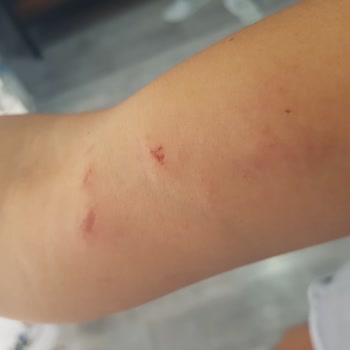 Dut Gibi Darp Tehdit Küfür Saldırı