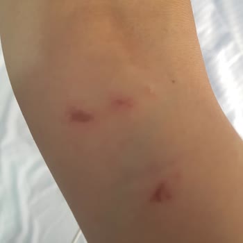 Dut Gibi Darp Tehdit Küfür Saldırı