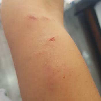 Dut Gibi Darp Tehdit Küfür Saldırı