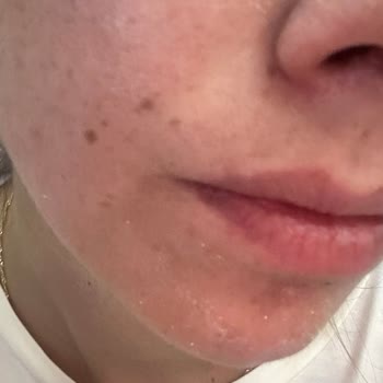 Yves Rocher ANTI-AGE Global Radiance Kremi