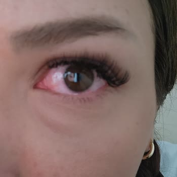 Özüm Cevher Beauty Center İpek Kirpik Felaketi