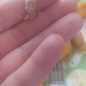 Erpiliç Nugget İçinden Sivri Kemik Çıktı!