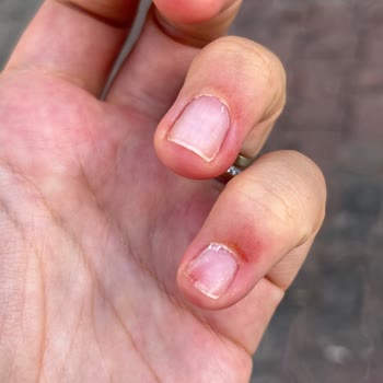 Tırnak Butik Model Arıyordu, Mahvedilen Kağıt Gibi Tırnaklarım