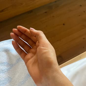 Rossmann Sunozon Kına Lekesi Gibi Leke Bıraktı Elimde Ve Vücudumda