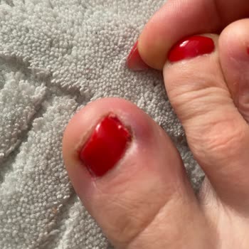 Hare Kuaför & Tesettür Pedikür Sonrası Parmağımda Dolama Enfeksiyon Oldu