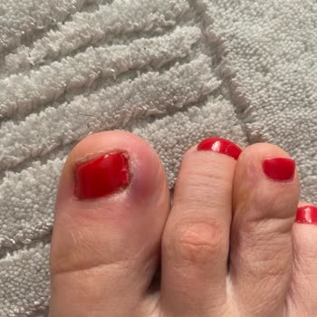 Hare Kuaför & Tesettür Pedikür Sonrası Parmağımda Dolama Enfeksiyon Oldu