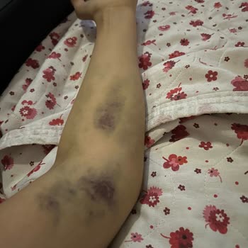 Seyrantepe Şişli Etfal Hastanesi Kan Alma