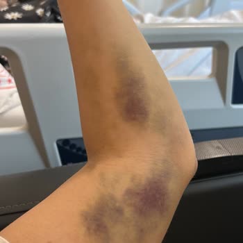 Seyrantepe Şişli Etfal Hastanesi Kan Alma