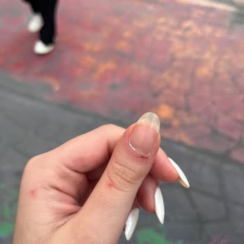 Vip Estetik Güzellik Asla Gidilmemesi Gereken Bir Yer