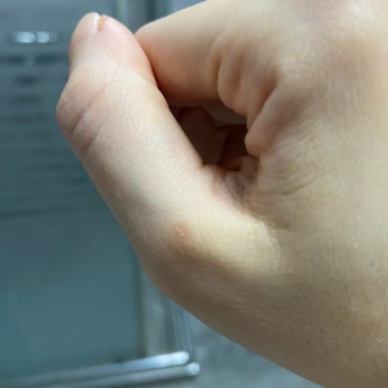 Dyson Süpürgem Derimi Yakıyor!