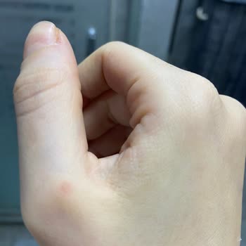 Dyson Süpürgem Derimi Yakıyor!