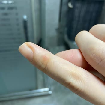 Dyson Süpürgem Derimi Yakıyor!