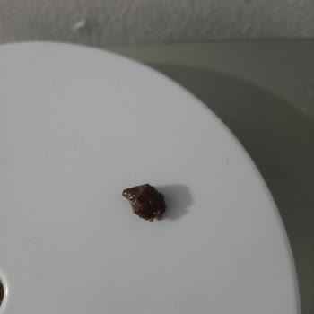 Ülker Çokokrem'in İçindeki Yabancı Cisim