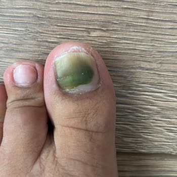 Gratis Beauty Kalıcı Ojenin Tırnağıma Zarar Vermesi.