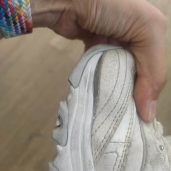 Skechers Yeni Ayakkabı Yırtıldı