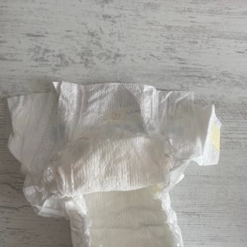 Prima Bezlerin Bantları Kopuyor!
