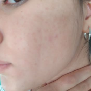 Rise & Shine Dilan Polat Ürünü: Yüzümde Tahrişe Neden Oldu