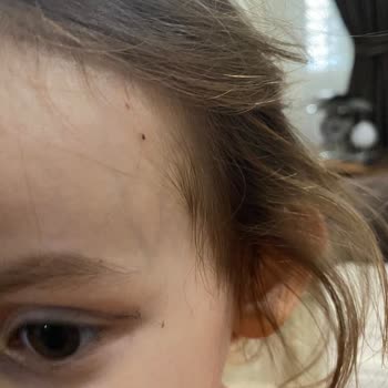 Özel Gözde Çocuklar Anaokulu'nda Çocuğuma Verilen Zarar