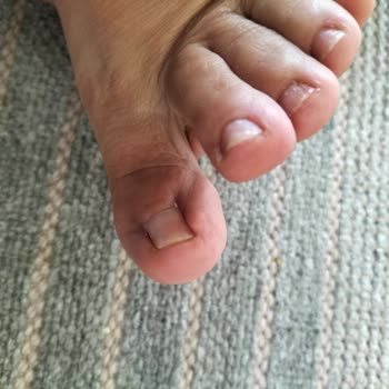 Çankırı Özel Karatekin Hastanesi Başarısız Operasyon