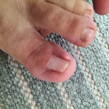 Çankırı Özel Karatekin Hastanesi Başarısız Operasyon