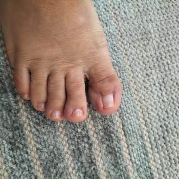 Çankırı Özel Karatekin Hastanesi Başarısız Operasyon