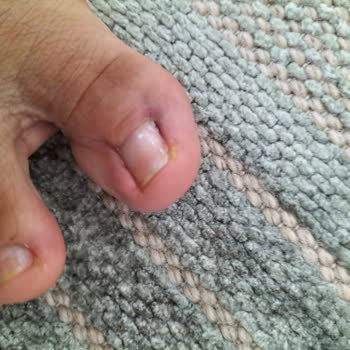 Çankırı Özel Karatekin Hastanesi Başarısız Operasyon