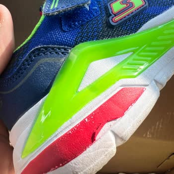 Skechers Ayakkabı Kalite Sorunu