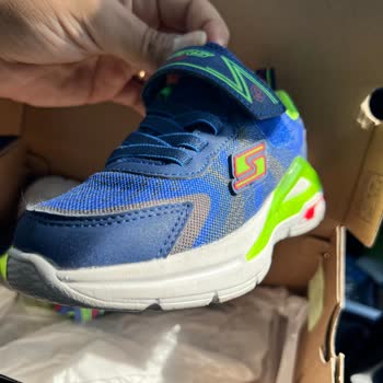 Skechers Ayakkabı Kalite Sorunu