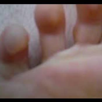 Nike Ayakkabının Ayağı Vurması