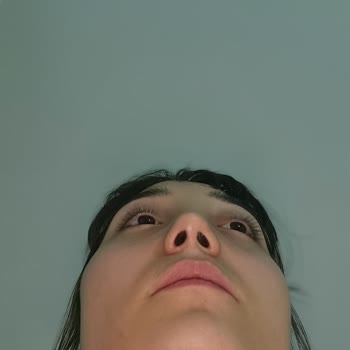 Vanity Estetik Burnum Yamuk Yapıldı Ve Revizyon Yapmıyorlar