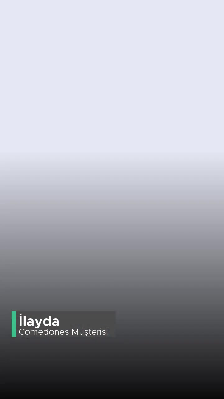 Comedones Tartım Çalışmıyor videonun kapak resmi