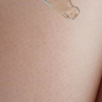 S'he Vec. Hydra Back Baby Serumum Küflendi