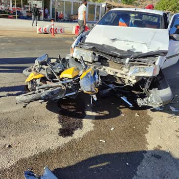 TVS Motor Kaza Yaptım Servis Yapmıyor