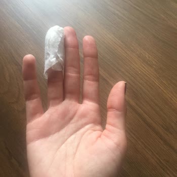 Karaca Züccaciye Karaca Pia Skull Mug'ın Elde Yıkama Esnasında Kırılarak Yaralaması