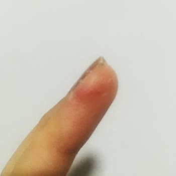 Karaca Züccaciye Karaca Pia Skull Mug'ın Elde Yıkama Esnasında Kırılarak Yaralaması