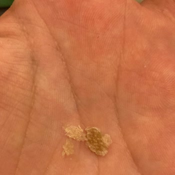 DP Şampuan Kafa Derisi Dökülmesi, Soyulması Ve Saç Döküntüsü Yaptı!