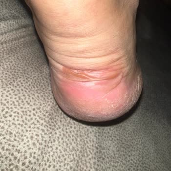 Sneaks Up Ayakkabının Ayağımı Vurması Sebebi İle Bir Numara Ustu İle Değişim