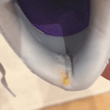 Skechers Ayakkabı 3 Ayda Çöp Oldu
