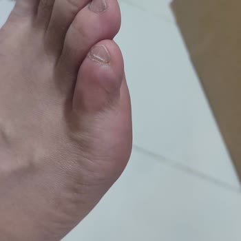 Puma Mağdur Ediyor Alma Aldırma...