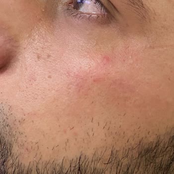 Gratis'in Ve Claderm Marka Kalitesiz Mal Satması!