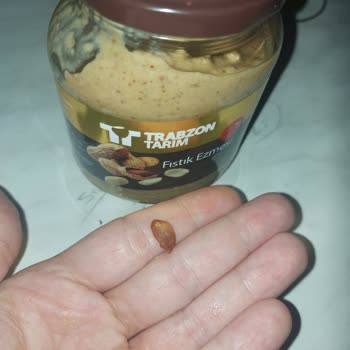 Trabzon Tarım Fıstık Ezmesinden Taş Gibi Bir Şey Çıktı